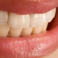 How Long Does a Dentist Appointment Last?