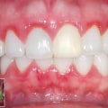 What Can Your Dentist Uncover From Your Teeth?