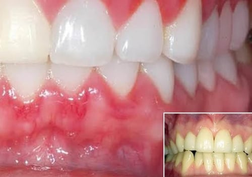 What Can Your Dentist Uncover From Your Teeth?