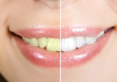 The Difference Between Aesthetic and Cosmetic Dentistry: A Comprehensive Guide
