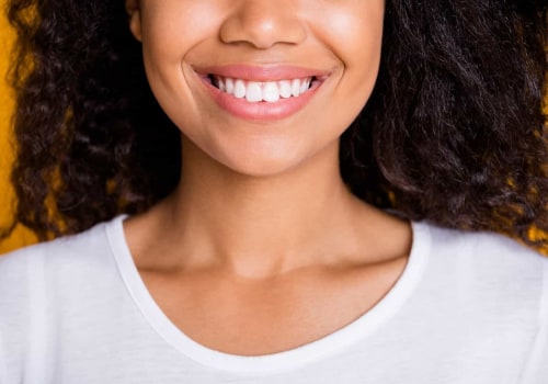 What is the Cost of Teeth Whitening in Orange County?