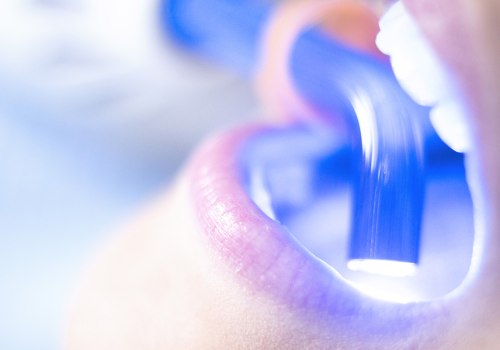 Laser Dentistry in Orange County: Find the Best Specialist
